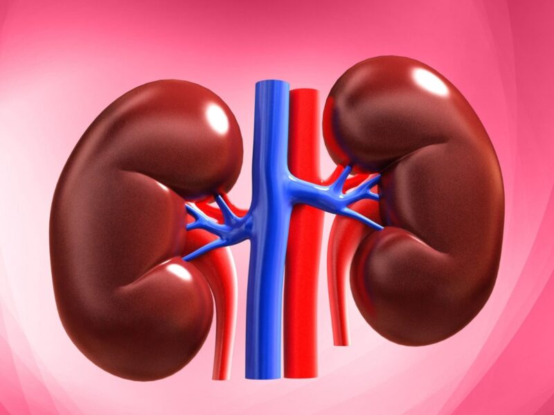 Kidney Detox: 5 Foods That Can Help Remove Impurities And Prevent Kidney Stones