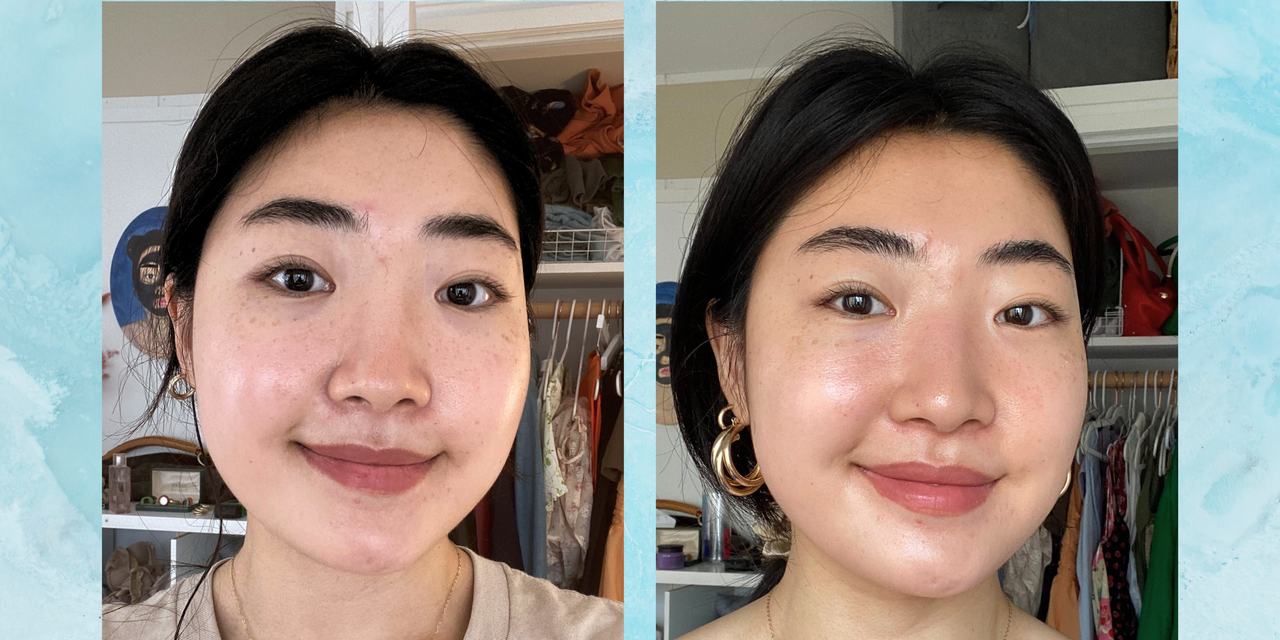I Tried the Viral HydraFacial for My Ultra-Sensitive Skin