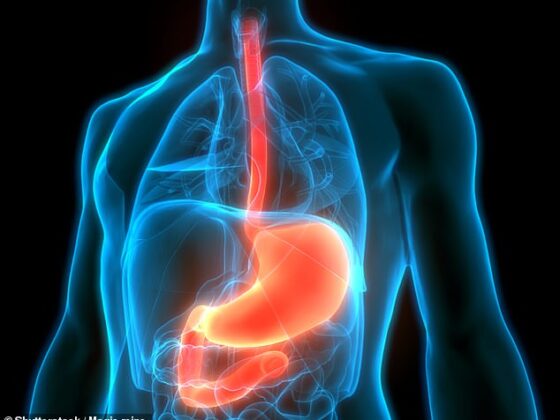 With more people developing reflux because of obesity and lack of exercise, and concerns over the health risks from the long-term use of over-the-counter proton pump inhibitor drugs (PPIs) to treat it, there is likely to be a growing clamour for such surgery (stock photo)