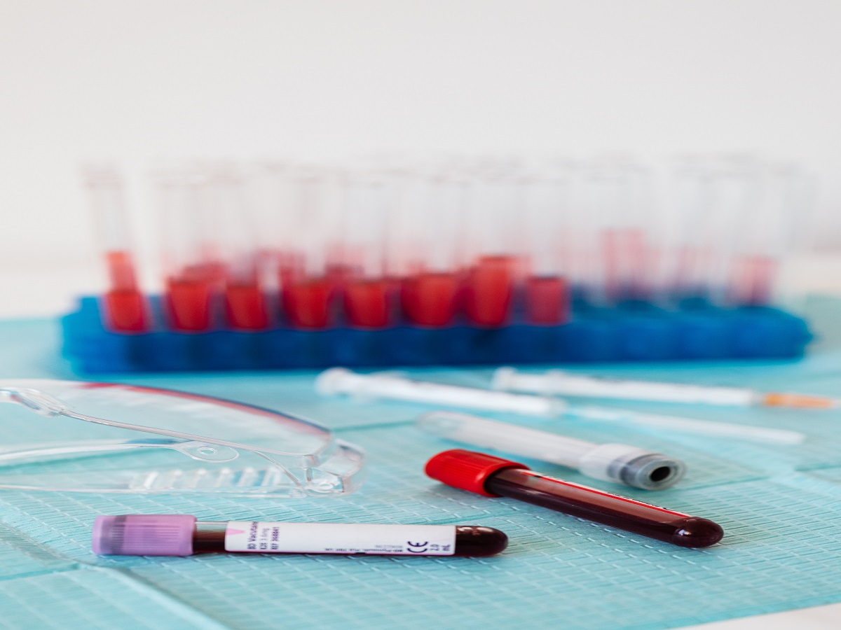 Cancer Patients Should Know These Five Benefits Of Liquid Biopsy