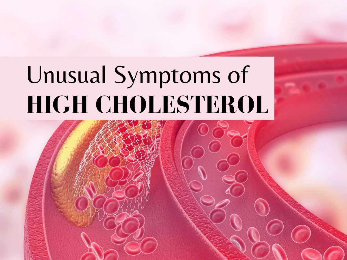 High Cholesterol Symptoms: 5 Uncommon High Cholesterol Signs To Look Out For