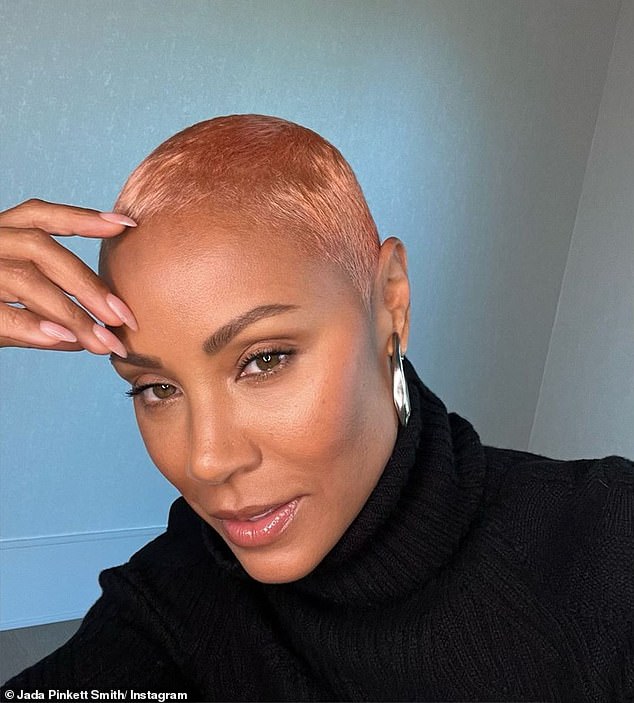 Jada Pinkett Smith, pictured, suffers from Alopecia areata, a common hair loss condition which affects 100,000 Britons