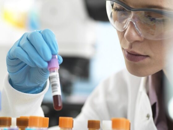 Simple blood test could predict risk of Alzheimer's 20 years in advance, study finds