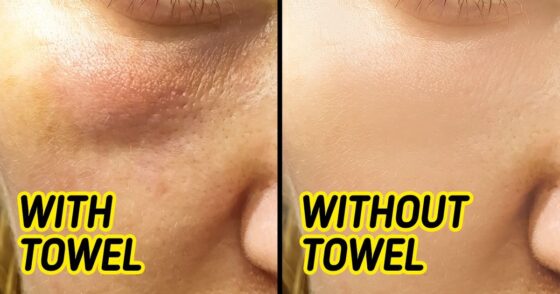 Why You Shouldn’t Use a Towel to Dry Your Face