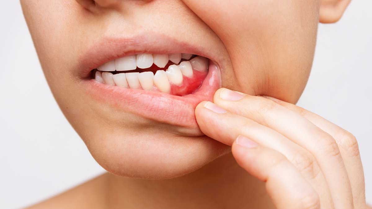 Do your gums bleed a lot? This is why it could lead to LUNG DISEASE