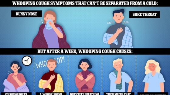 England is battling its biggest outbreak of '100 day' whooping cough in at least 10 YEARS - so how can you tell it apart from a cold?