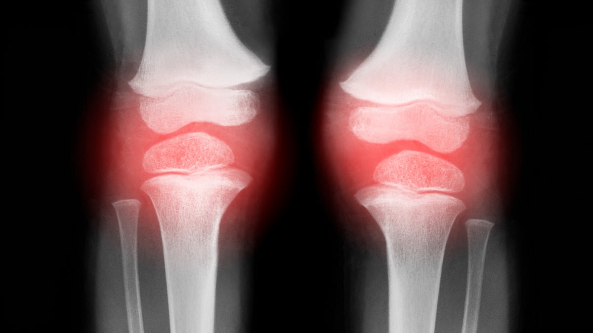 My knees turn purple when I sit for too long but I don't know why: Ask the GP DR MARTIN SCURR