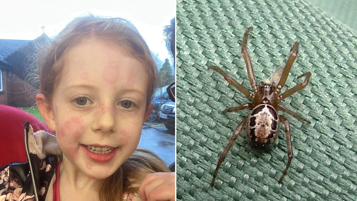 'Britain's most dangerous spider' strikes in Hampshire: Girl, 5, is left unable to walk and covered in rashes after a bite from a noble false widow