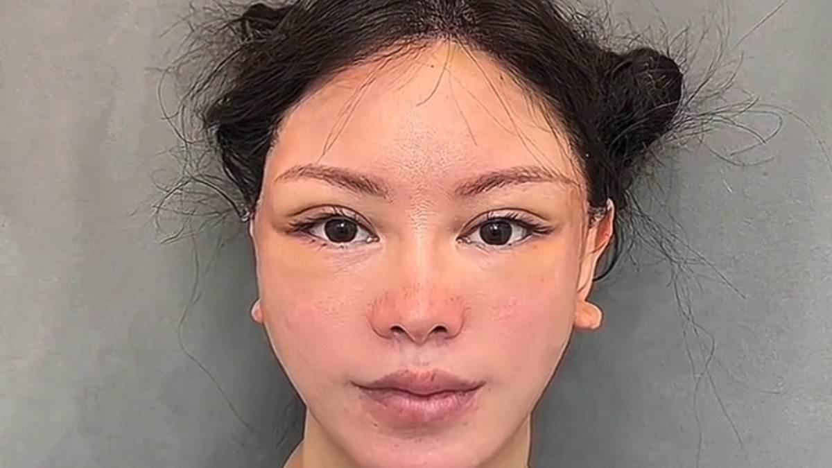 'If this is real, you screwed up': Social media goes wild over TikTok doctor's 'scary' before-and-after transformations of $50,000 facelifts