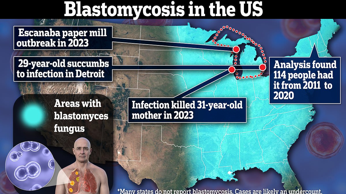 Frightening maps show how deadly fungal diseases are surging across the US - as Michigan woman reveals lung-destroying strain has killed TWO of her relatives