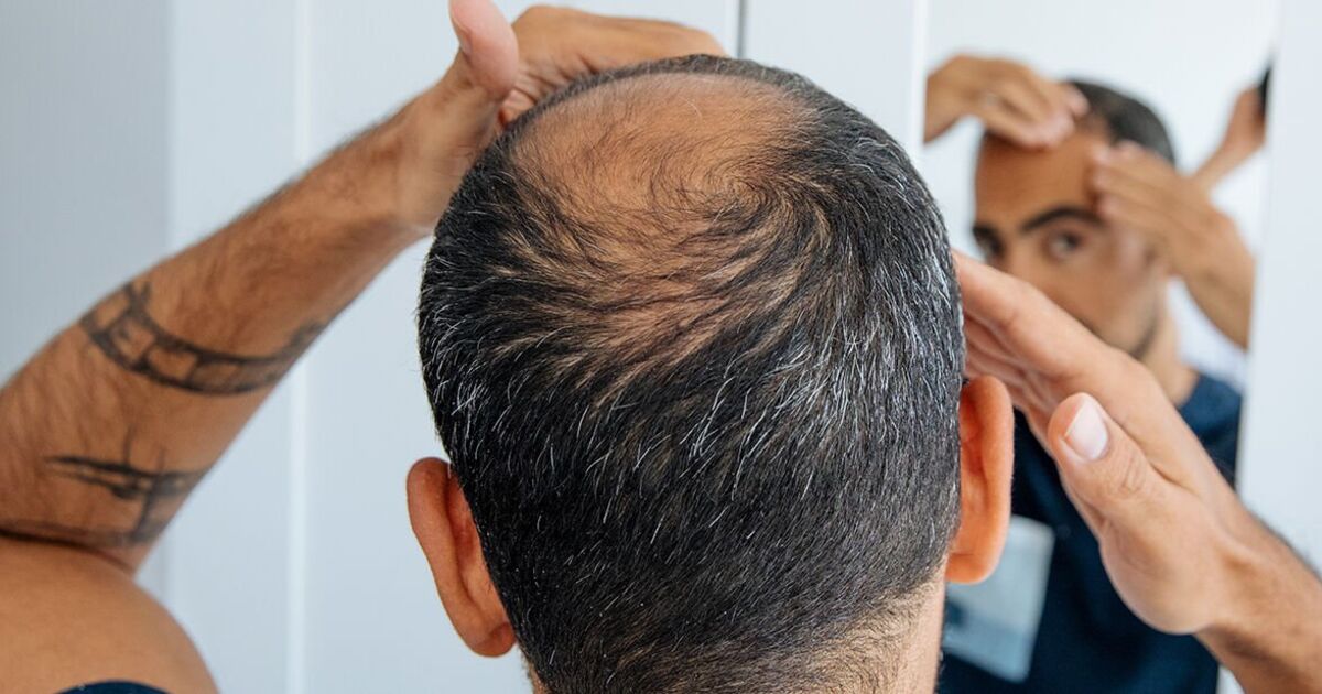 Men using finasteride for hair loss 'at risk' of missing prostate cancer diagnosis