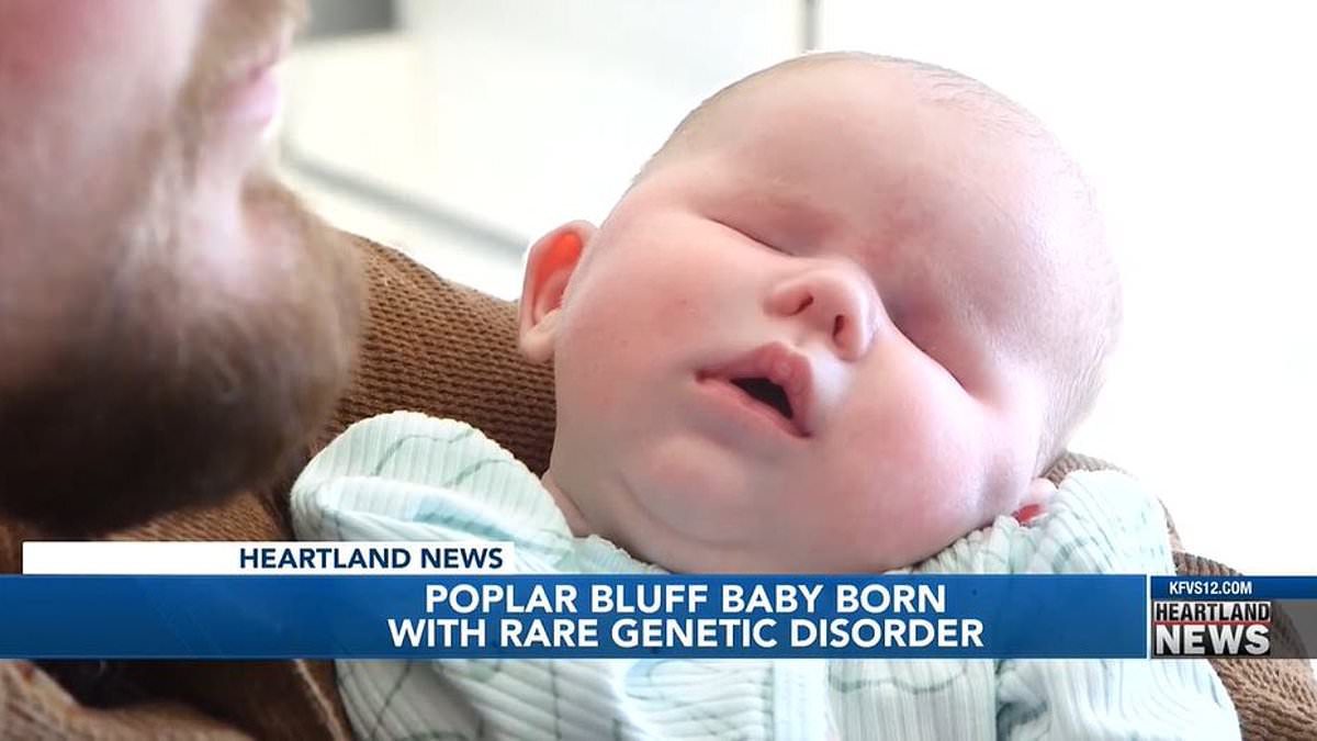 Missouri parents are left stunned after baby daughter is born without EYES: Infant has rare genetic disorder only known to affect 30 people in world