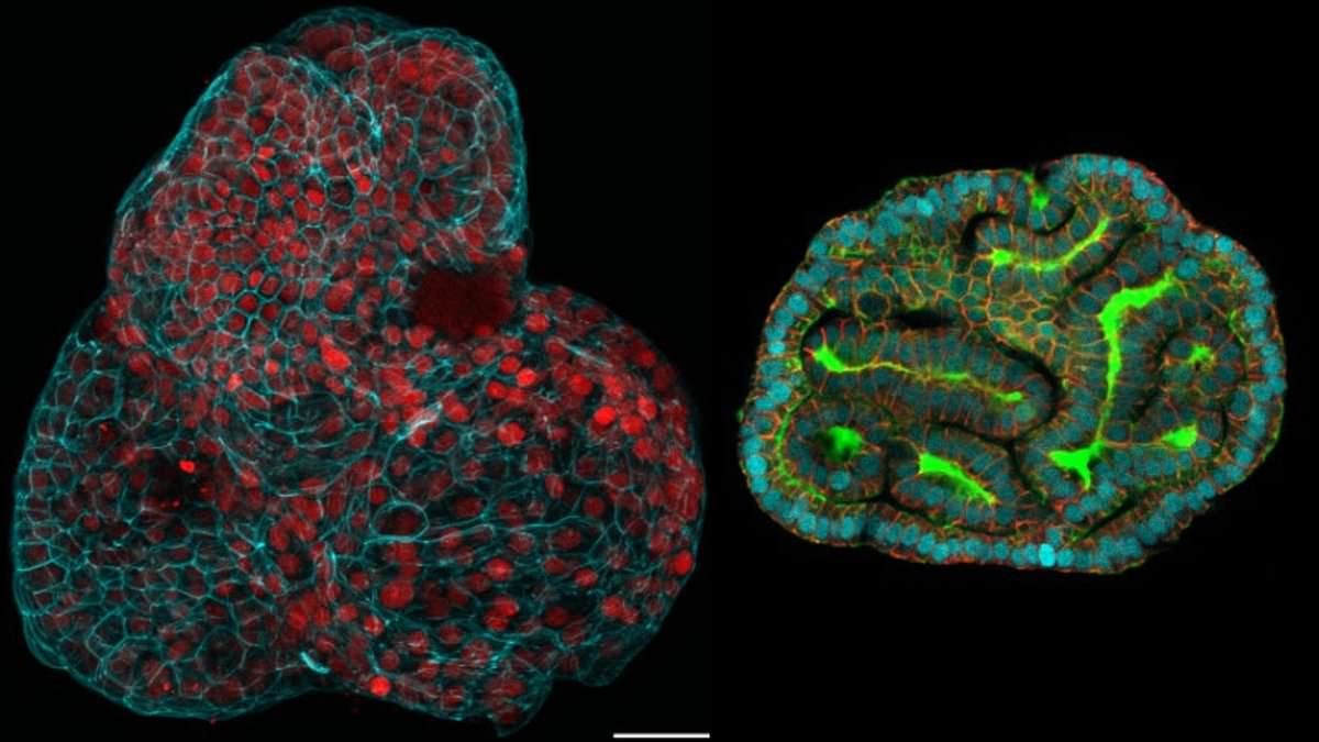 'Mini organs' are grown from human stem cells taken during the late stages of pregnancy for the first time - marking a 'huge step forward' for prenatal medicine