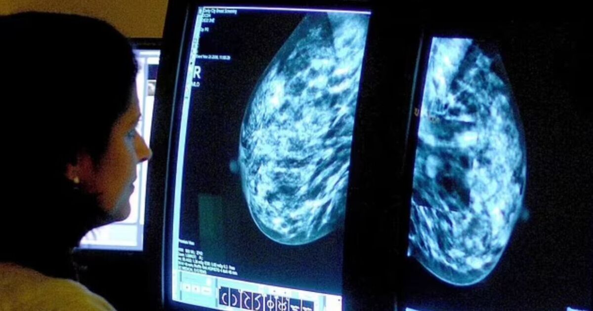 Breast cancer breakthrough as science discovery could kill 'hibernating' tumour cells