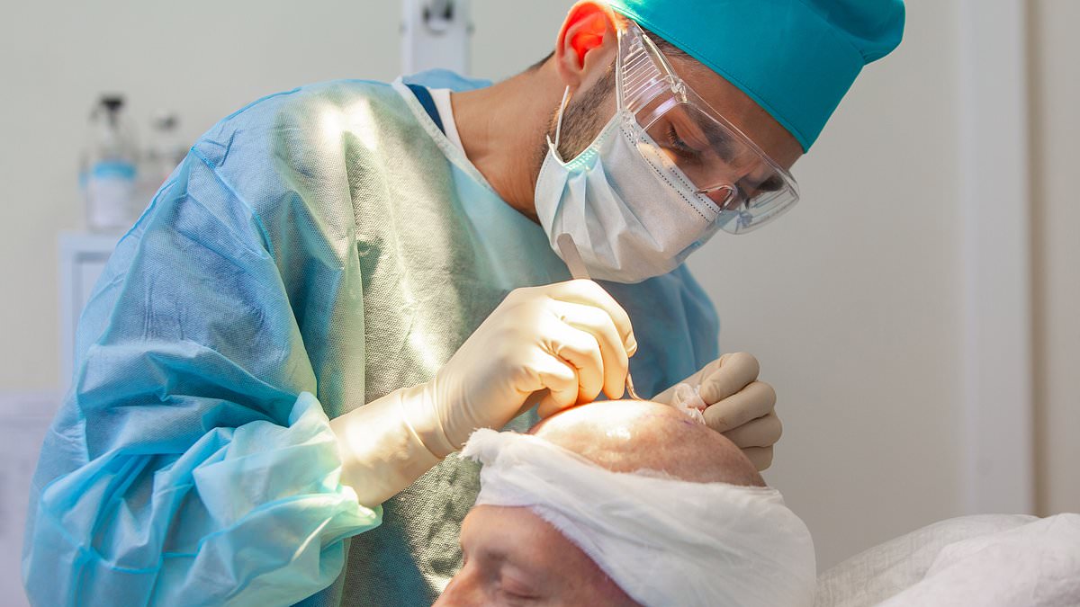 Don't have a hair transplant without reading this! Our experts reveal the questions you MUST ask - and how to tell if a fake doctor is doing your op...