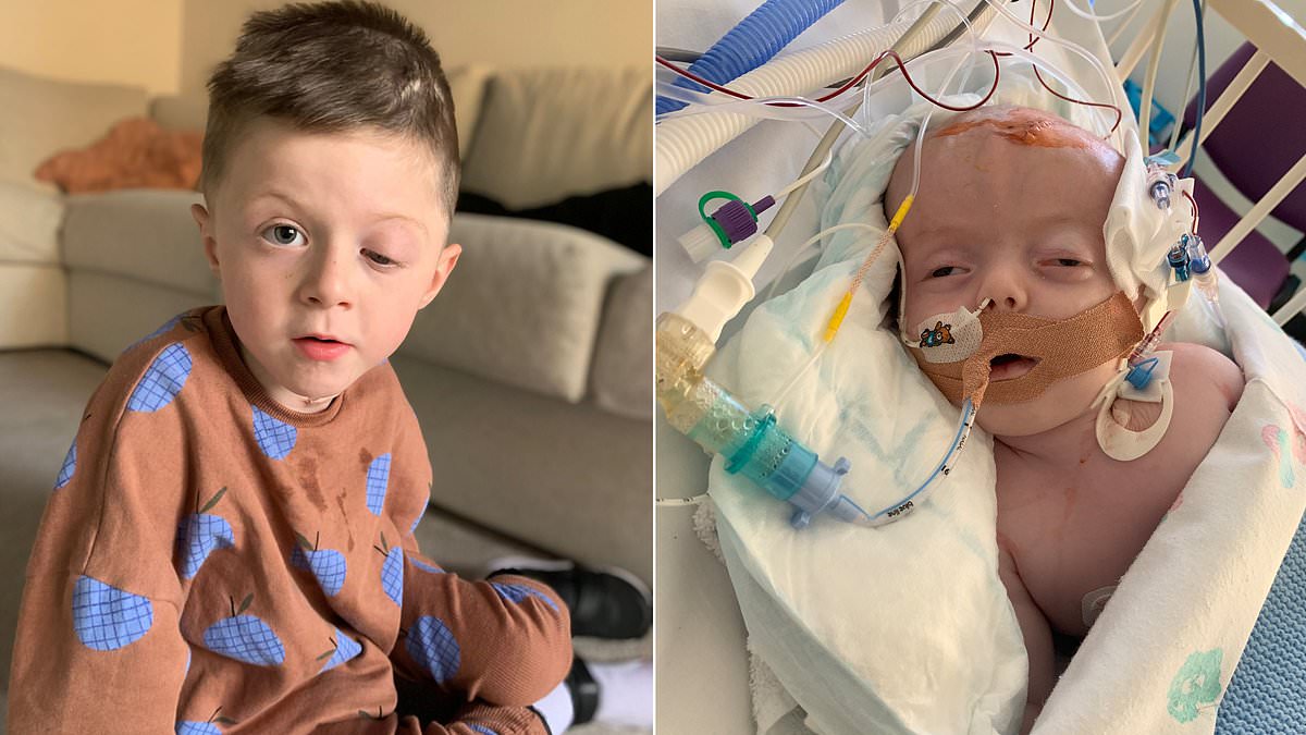 How little Roux is fighting fit after 13 OPERATIONS on a brain tumour as big as two oranges that he was diagnosed with when he was just four weeks old