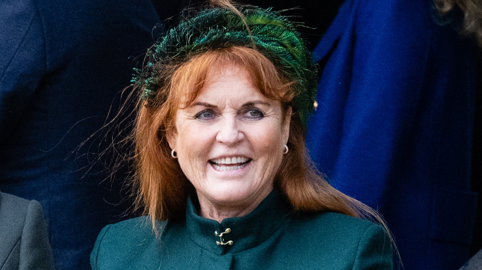 The Cosmetic Procedures Sarah Ferguson Admits To Getting