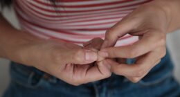 Doctor warns of little-known nail symptom that could be sign of life-threatening disease