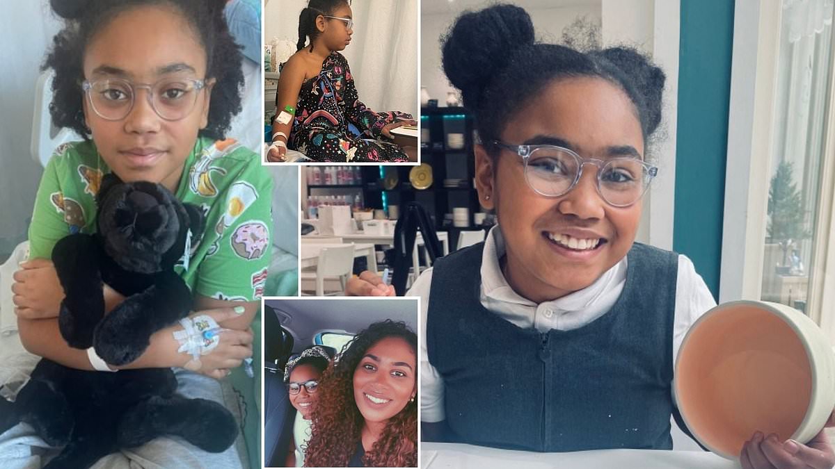 Girl, 11, misdiagnosed 30 times over three years before the real, and devastating, cause of her headaches and nausea was uncovered