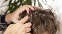 Headlice warning issued as leading high street retailer sees spike in sales for treatment