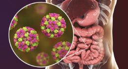 Warning of 'winter vomiting bug' outbreak... in May! Norovirus infections hit a five-year seasonal high as health chiefs urge public to stay off work for two days if suffering symptoms
