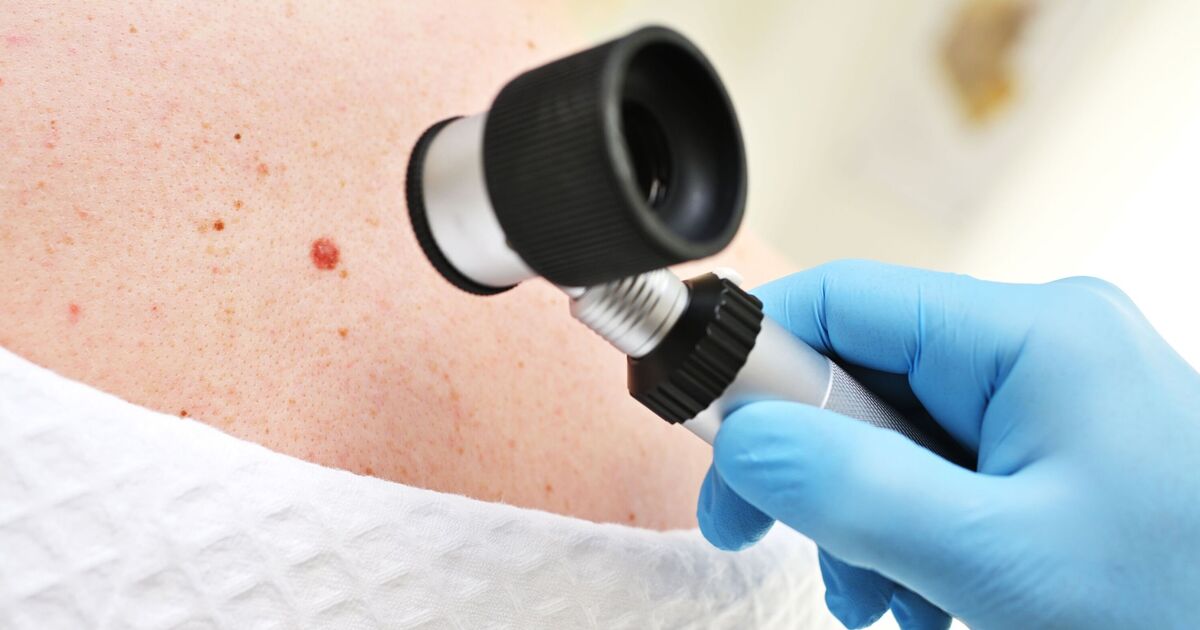 'Exciting' skin cancer vaccine halves risk of relapse or death in study