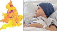 Cancer patients given warning as deadly illness surges through UK - full list of hotspots