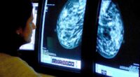 Fascinating reason why breast cancer returns decades after it's 'cured'...as deaths in young women with the illness soar