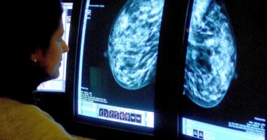 Fascinating reason why breast cancer returns decades after it's 'cured'...as deaths in young women with the illness soar