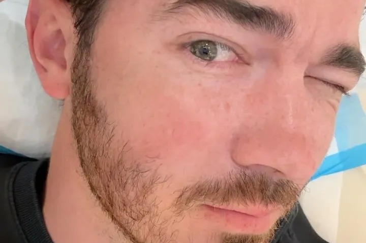 Kevin Jonas reveals skin cancer diagnosis as he gets surgery to remove mole and tells fans ‘get checked’