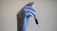 Simple blood test could help detect Parkinsons seven years before it strikes