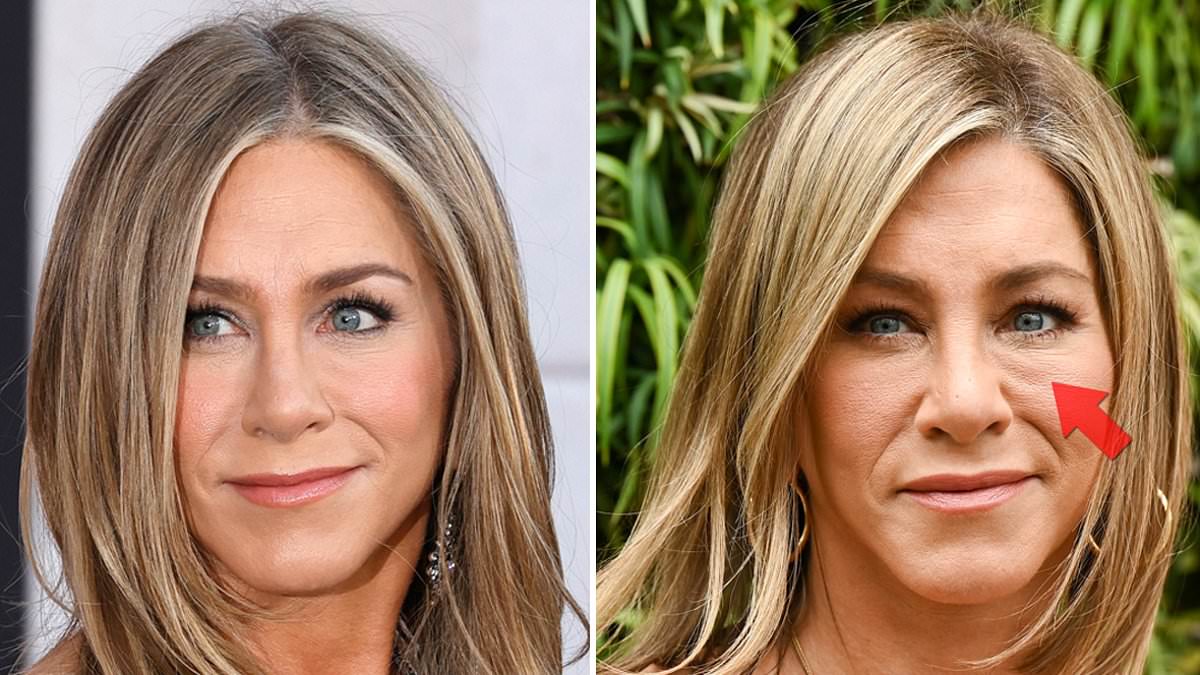 Surgeon claims Jennifer Aniston's new 'tired and aged' face is due to botched filler - years after actress said plastic surgery was a 'slippery slope'