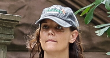 Katie Holmes sparks concern with mysterious bruise on face as actress seen walking alone during outing in NYC