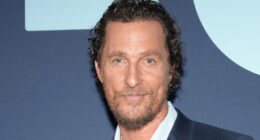 Matthew McConaughey shares shocking photo of swollen face from a bee sting as concerned fans ask ‘are you alright?’