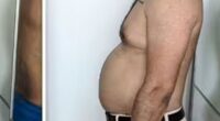 Middle-aged man loses pot belly in just 4 weeks with 45-minute workout regime