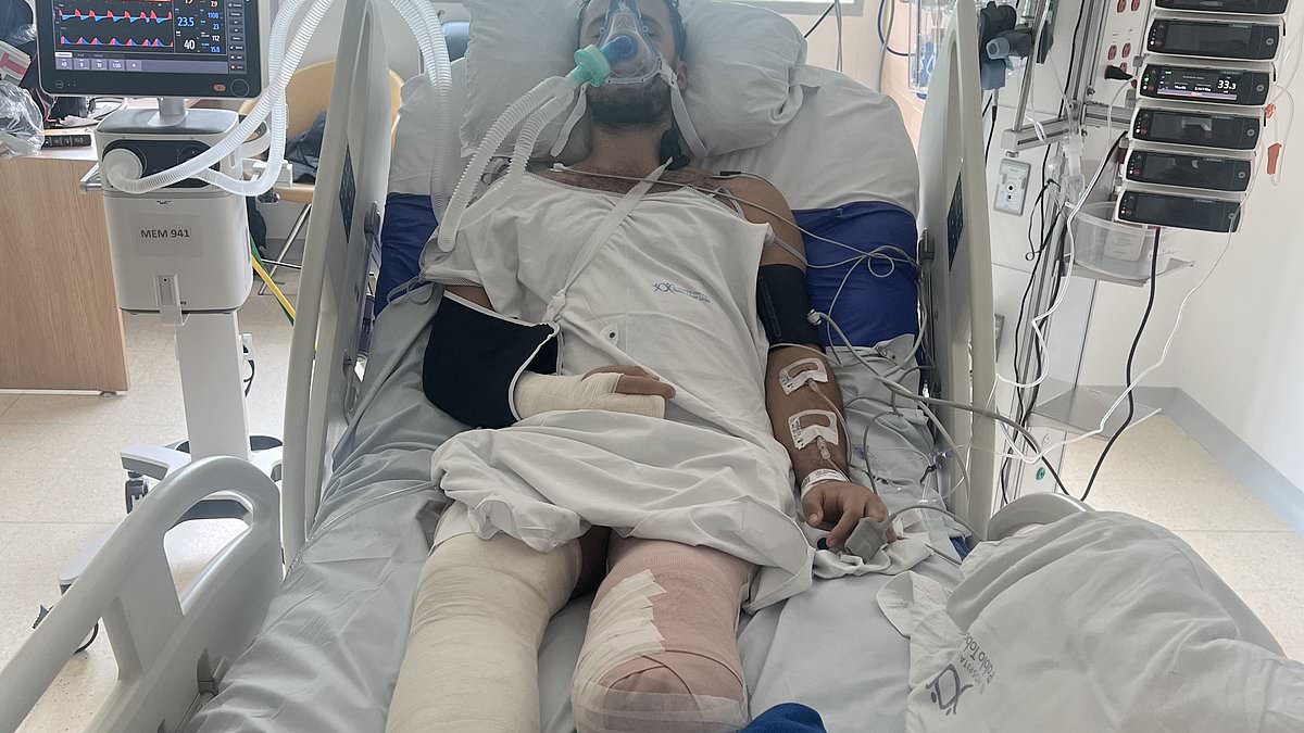 Motorbike holiday horror smash: Thrill seeking banker, 28, had to have his 'dead' leg amputated after life-changing road accident on dream South American trip and says: 'I knew it was high-risk.... something was bound to happen eventually'