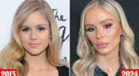 Plastic surgeon reveals which procedures 'The Boys' star Erin Moriarty has had... and why it looks so different