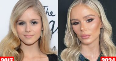 Plastic surgeon reveals which procedures 'The Boys' star Erin Moriarty has had... and why it looks so different