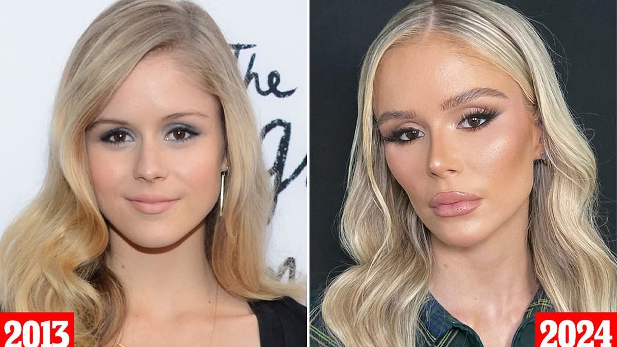 Plastic surgeon reveals which procedures 'The Boys' star Erin Moriarty has had... and why it looks so different