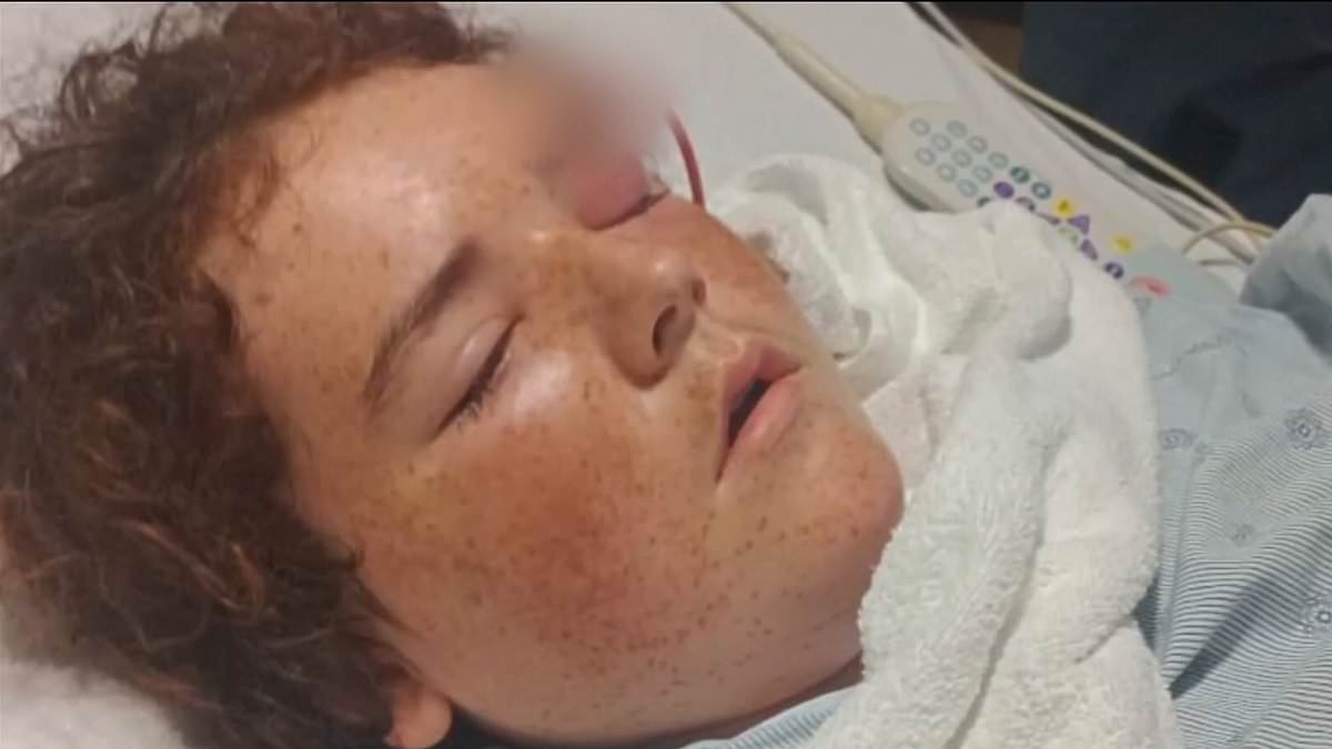 Texas boy, 13, left with plastic pipe sticking out of his head after swim with friends triggered illness that could have killed him