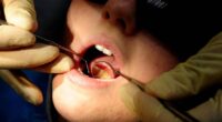 Dentist explains five warning signs of 'concerning' condition