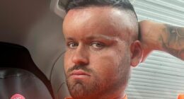 Horror hair dye reaction left man, 27, with a giant 'BALLOON HEAD' like the cartoon character Megamind