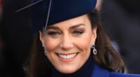 How Kate Middleton Supposedly Got The Scar On Her Head