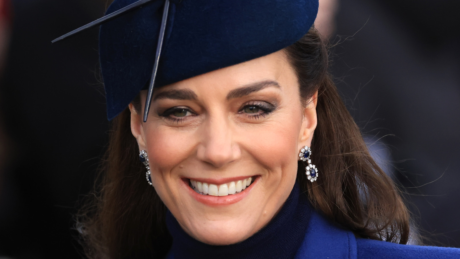 How Kate Middleton Supposedly Got The Scar On Her Head