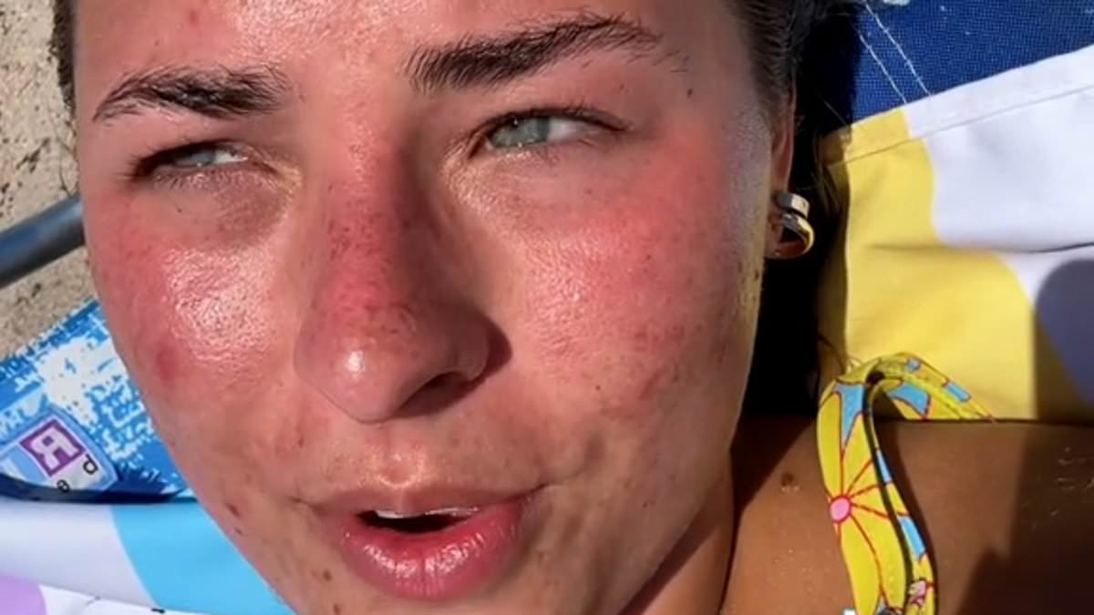 Insane TikTok trend for 'sunburning' which influencers claim can heal acne and boost immunity... but doctors warn against trying it