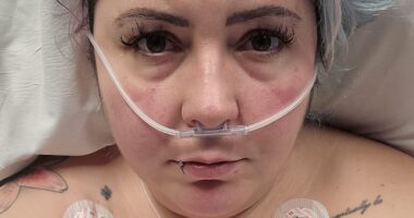 London woman, 33, nearly killed by £4.5k gastric balloon that got 'stuck' in her bowel