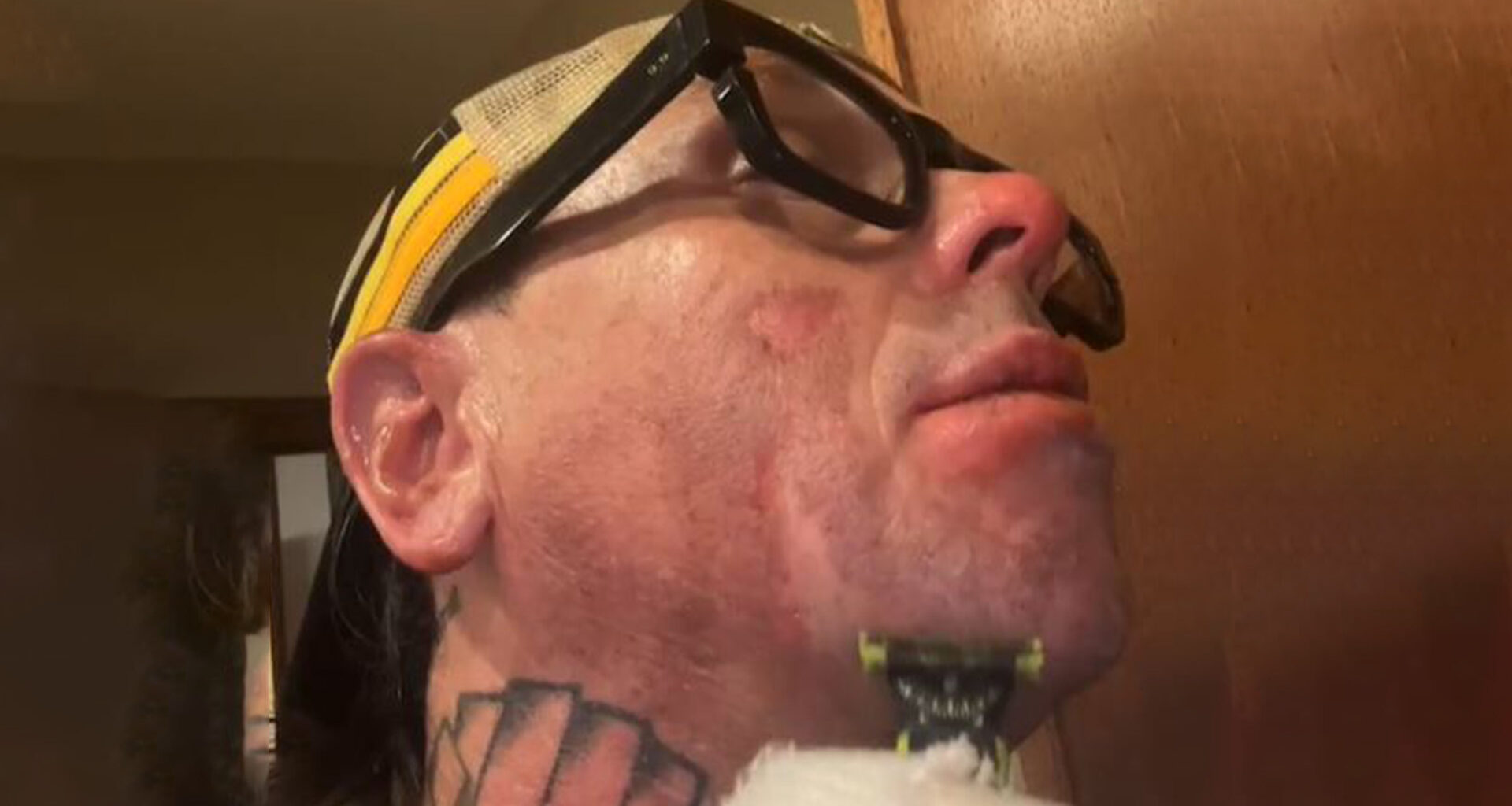 Slipknot’s Sid Wilson shares intense video ‘shaving a burn’ after being hospitalized for fire accident