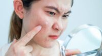 Dermatologist shares 'fastest way' to get rid of a big painful spot