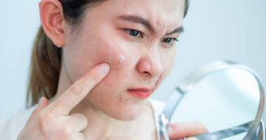 Dermatologist shares 'fastest way' to get rid of a big painful spot