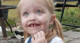 Mississippi girl, 5, receives double-lung transplant after rare condition turned her body blue